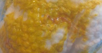 Стафилококк и цитробактер. Бурлит в животе, ребенку 4 месяца