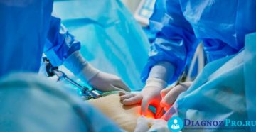 Лапароскопия во время менструации Лапароскопия во время менструации