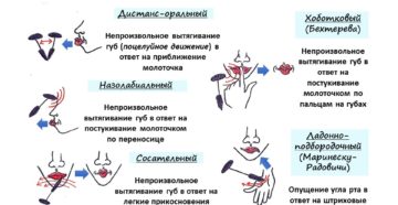 Оральный автоматизм-обратимо ли это явление?