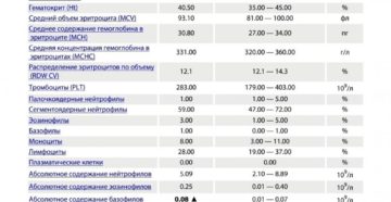 Повышенные базофилы и моноциты у ребёнка 2,5 года