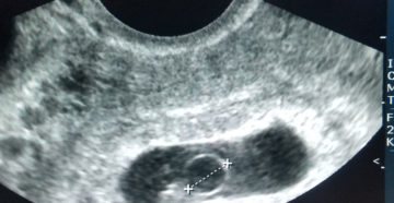 Есть ещё одно плодное яйцо?