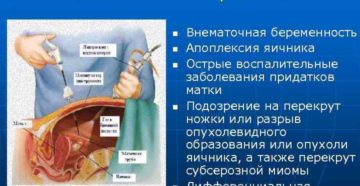 Подозрение на внематочную беременность