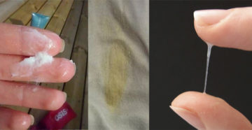 Пенистые выделения белого цвета после полового акта