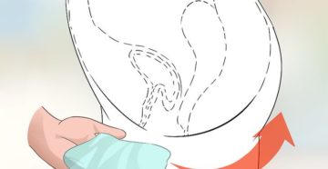 Неприятные звуки из влагалища Неприятные звуки из влагалища