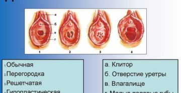 Как может растянутся девственная плева?