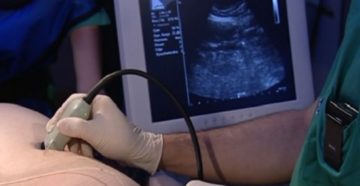 УЗИ после лапароскопии