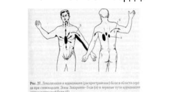 Дискомфорт в области сердца при смене положения тела