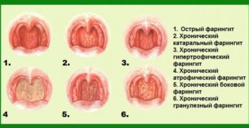 Температура 39.5 и красное горло