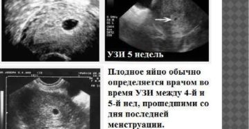 Беременность малого срока, расшифровка УЗИ