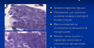 Что значит косвенные признаки железистого полипа Что значит косвенные признаки железистого полипа