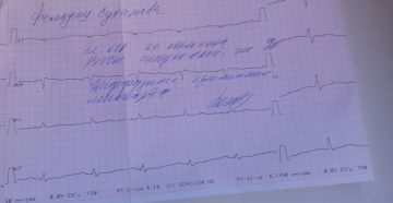 Мерцательная аритмия этацизин и предуктал