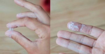 Выделения белые