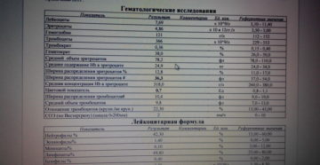 При аллергии анализ на иммуноглобулин Е быть в норме?