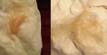 Капля крови на белье во время беременности