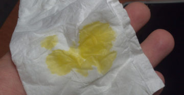 Желтые выделения на 11 неделе беременности