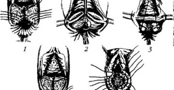 Разрыв влагалища
