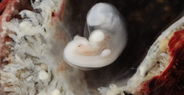 Беременность 3 недели Беременность 3 недели