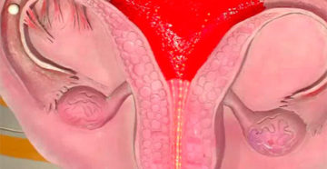 Месячные странно идут