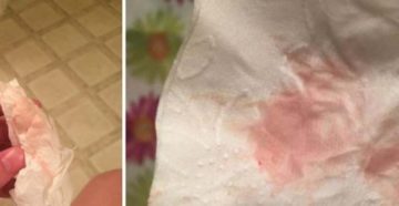 Бледно розовые выделения, дюфастон, жгет соски, болит грудь. Цикл регулярный