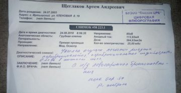 Описание флюорограммы