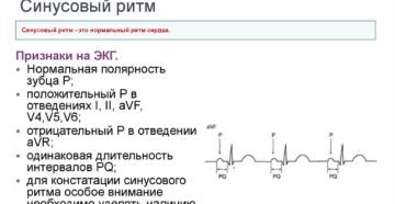 Синусовый ритм