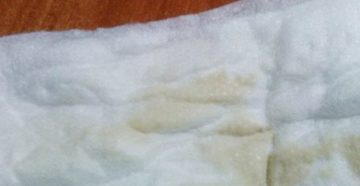 Задержка и бежевые выделения Задержка и бежевые выделения