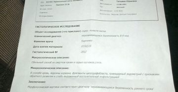 Результат анализа гистологии Результат анализа гистологии