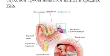 Двусторонняя дисфункция слуховых труб