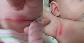 Красные половые губы у девочки в 3 года Красные половые губы у девочки в 3 года