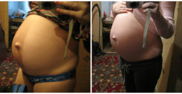 Шевеления слева живота