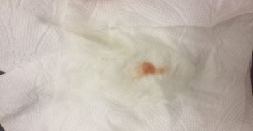 Что делать при коричневых выделениях на 7 неделе беременности Что делать при коричневых выделениях на 7 неделе беременности