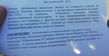 Помогите разобраться с КТ результатом