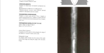 Расшифровка рентгеновского снимка Расшифровка рентгеновского снимка