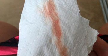 Кровянистые выделения после клотримазола