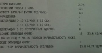 Расшифровка ктг, 39 недель Расшифровка ктг, 39 недель