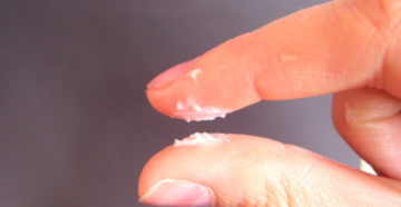 Былые выделения и сильно кремообразного вида