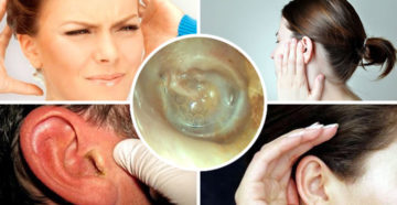 Заложило ухо после выстрела Заложило ухо после выстрела