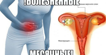 Подняла тяжёлое во время менструации болит живот в низу