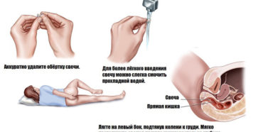 Опасны ли ректальные свечи, если были введены вагинально?