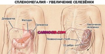 Увеличенная селезенка в 2 раза и лейкоциты 45,37 говорят о онкологи?