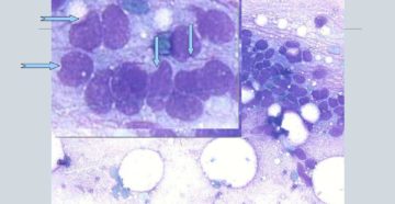 Цитологическое исследование желудка