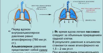 Боли в сердце при смехе и выдохе