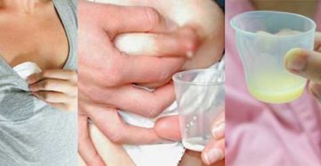 Выделение молозива из груди