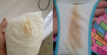 Желтоватые выделения на 17 неделе беременности