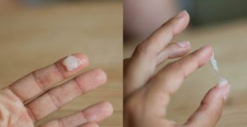 Беременность 37 неделя, прозрачные выделения. Обильные Беременность 37 неделя, прозрачные выделения. Обильные