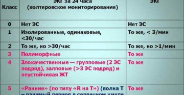 Экстрасистолия, нарушение ритма соответствует 4А классу градации ЖЭС по Лауну