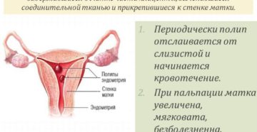 Замершая беременность плацентарный полип