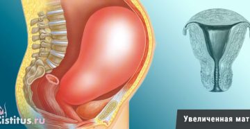 Матка не увеличена