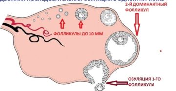 Возможна ли двойная овуляция
