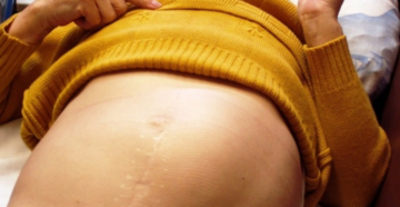 Увеличена ли печень и селезенка у ребенка?